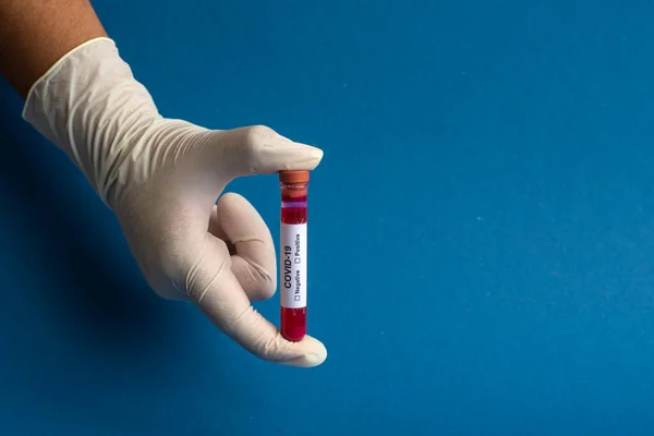 Hand Holding Test Tube Blood Sample Coronavirus 2019 Ncov Analyzing — Stock Photo, Image