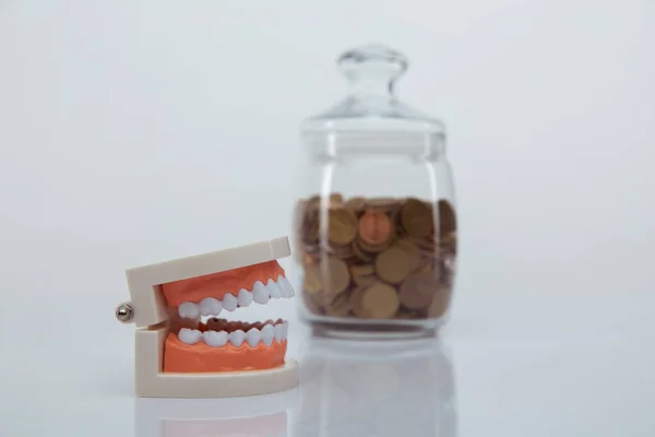 Model of jaw and glass bank with coins. Expensive dentists services concept — Stock Photo, Image