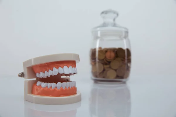 テーブルの上にコインと顎とガラス銀行のモデル。高価な歯科医サービスの概念 — ストック写真