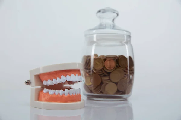 Modello di mascella e banca di vetro con monete primo piano. Concetto di servizi costosi per dentisti — Foto Stock