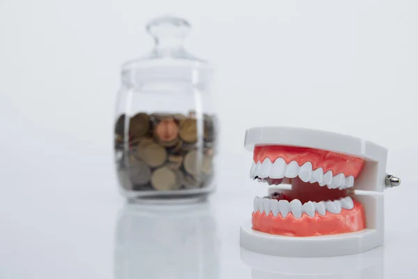 Model of jaw and glass bank with coins close-up. Money and dentist concept — Stock Photo, Image