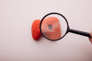 Tiroit bezinin hastalığını ya da patolojisini araştırın.