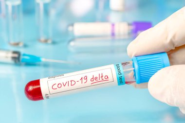 Doctor with a positive blood sample for the new variant detected of the coronavirus strain called covid DELTA. Research of new strains and mutations of the Covid 19 coronavirus in the laboratory clipart