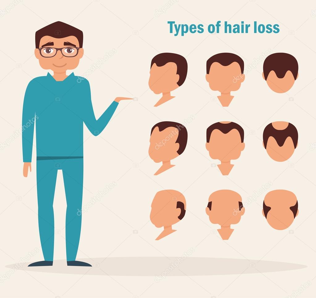 Types of hair loss.