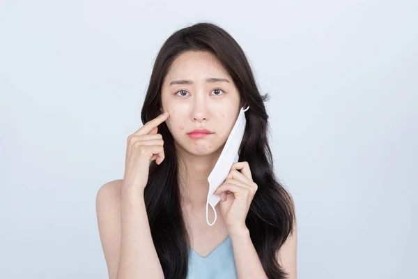 Bela Mulher Asiática Com Acne Espinha Problemas Pele Devido Uso — Fotografia de Stock
