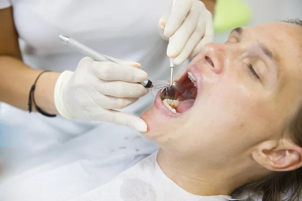 Paciente en el consultorio de higienistas dentales — Foto de Stock