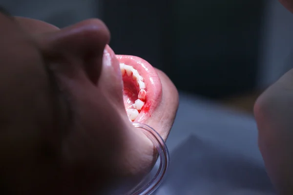 Paciente en el consultorio de higienistas dentales — Foto de Stock