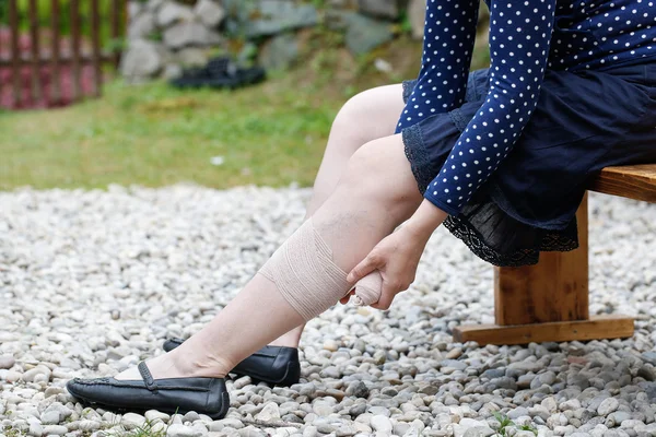 Mujer con venas varicosas aplicando vendaje de compresión — Foto de Stock