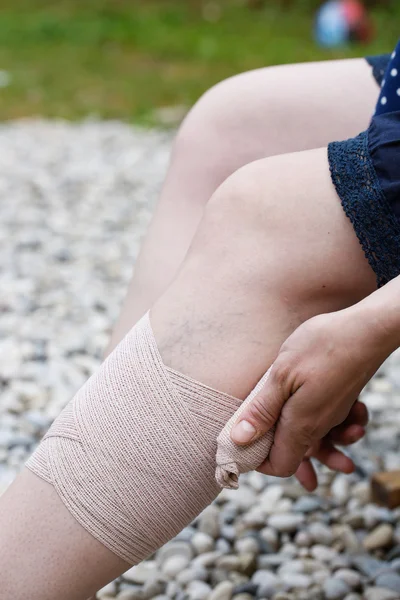 Femme avec varices appliquant un bandage de compression — Photo