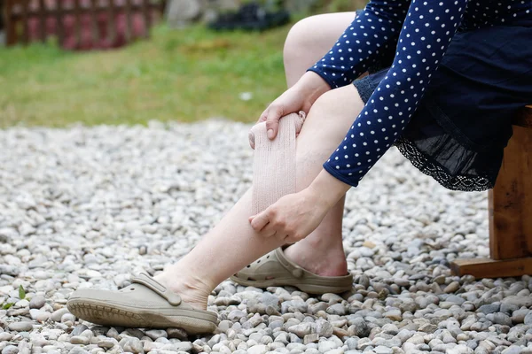 Femme avec varices appliquant un bandage de compression — Photo