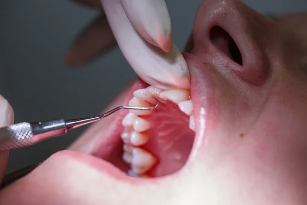 Patiënt op dental hygiënisten kantoor — Stockfoto