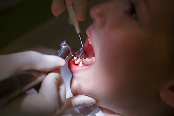 Mädchen bekommt ihre Zähne poliert — Stockfoto
