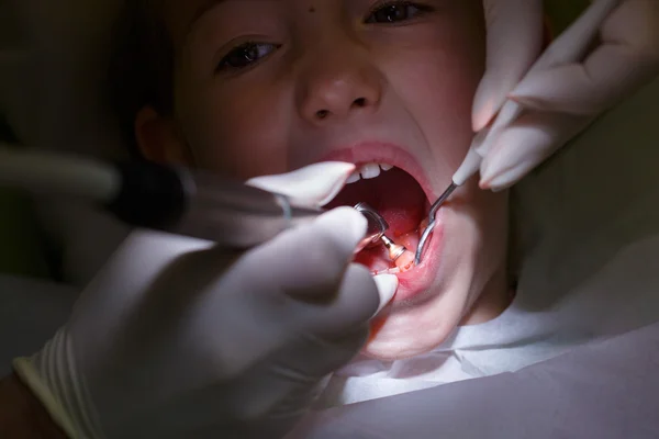 Menina recebendo seus dentes polidos — Fotografia de Stock