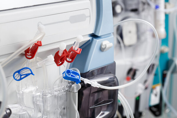 Hemodialysis bloodline tubes in dialysis machine