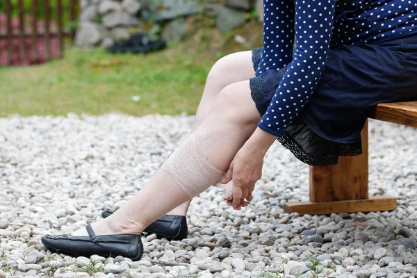 Woman with varicose veins applying compression bandage — Stock Photo, Image