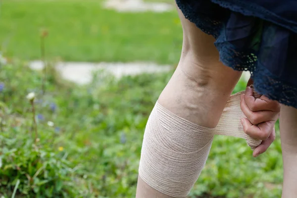 Femme avec varices appliquant un bandage de compression — Photo