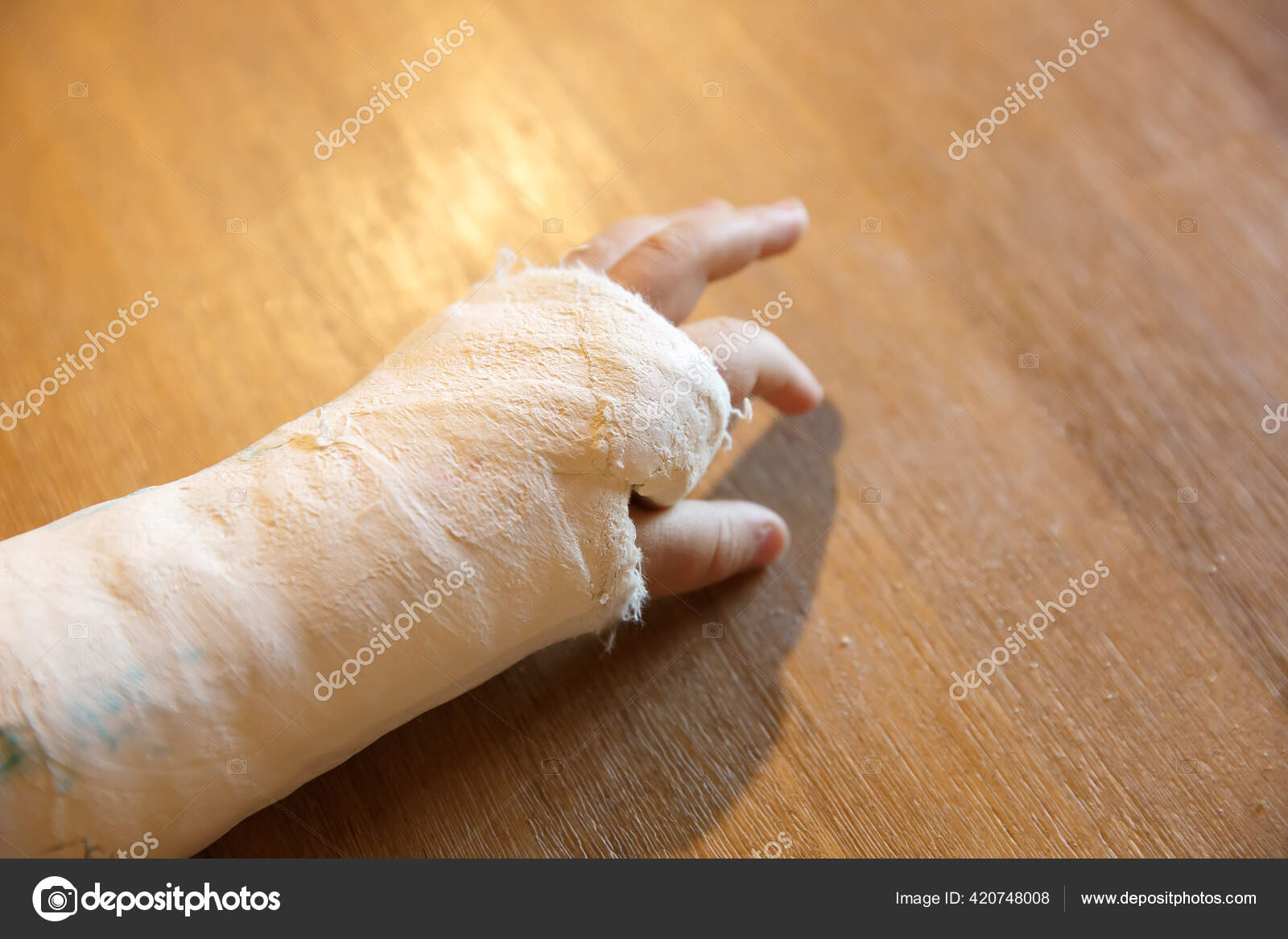 Close Broken Hand Cast Little Boy Standing Wall Stock Photo by