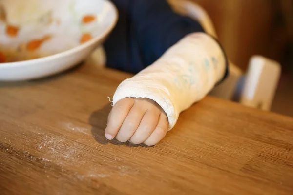 Niño Con Muñeca Rota Sentada Mesa Niño Con Yeso Mano —  Fotos de Stock