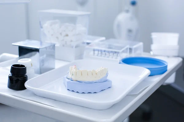 Molde de gesso dental — Fotografia de Stock