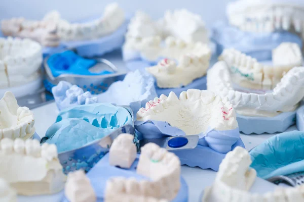 Dental plaster moulds and imprints — Stock Photo, Image