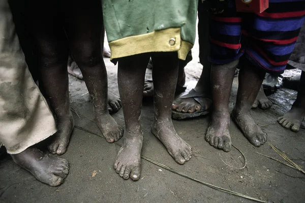 Poor African children — Stock Photo, Image