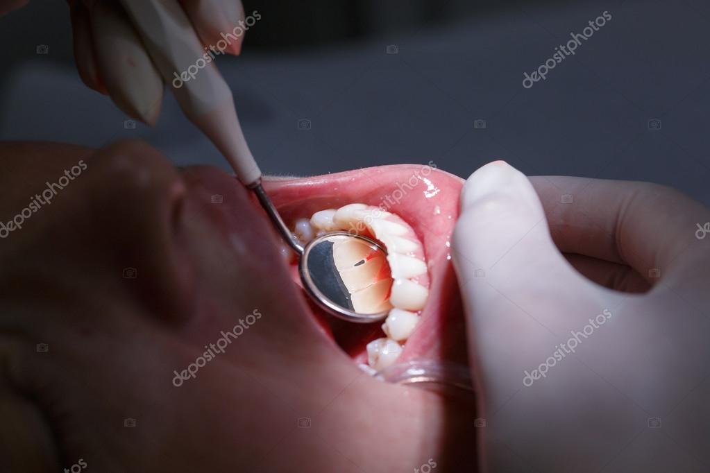 Patient getting her interdental spaces examined Stock Photo by