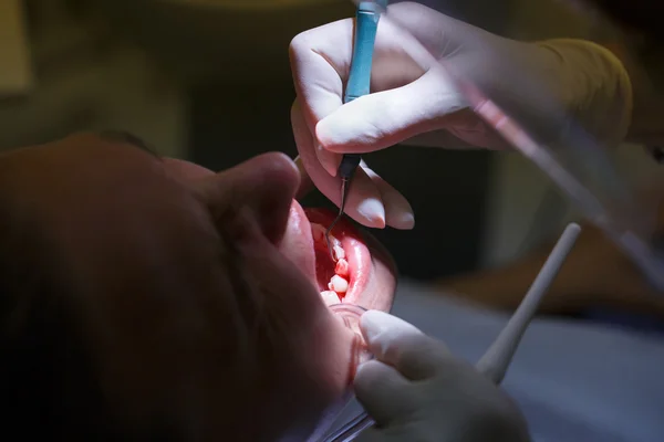 Diş Hijyenistleri ofisindeki hasta — Stok fotoğraf