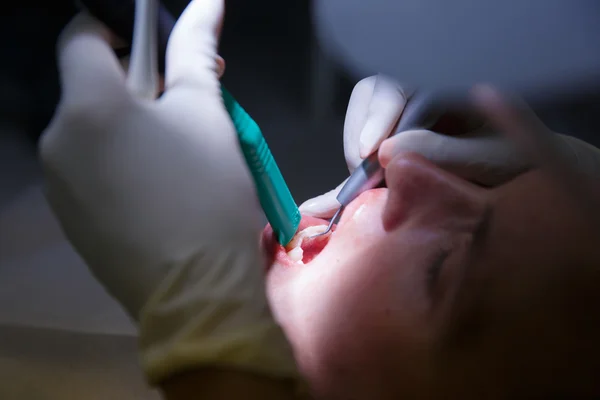 Пациент в кабинете стоматолога-гигиениста — стоковое фото
