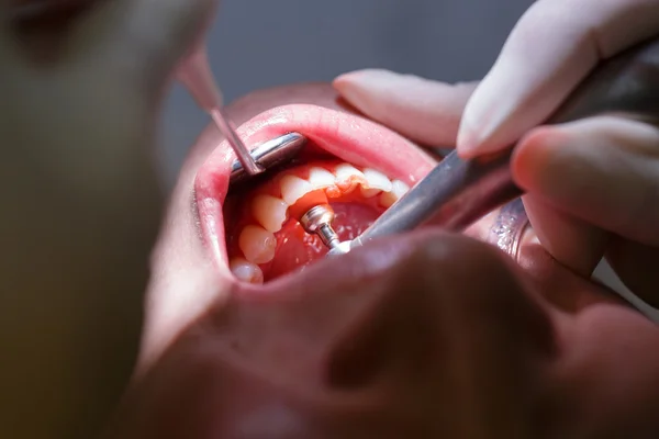 Paziente presso lo studio di igiene dentale — Foto Stock