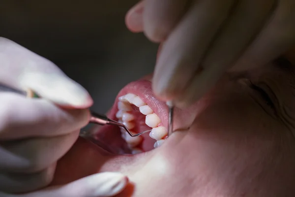 Patient på dentala tandhygienister office — Stockfoto