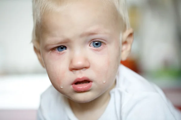 Criança pequena e chorosa com dor — Fotografia de Stock