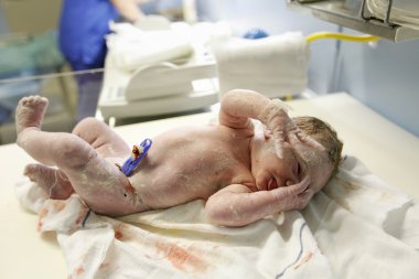 Vernix covered newborn in delivery room clipart