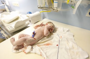 Doğumhane kaplı vernix Yenidoğan