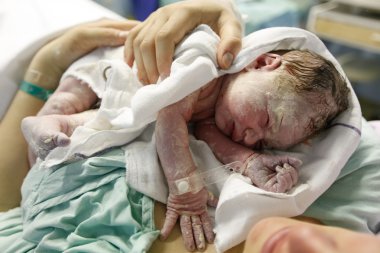 Kaplı vernix yeni doğan sarılma anne