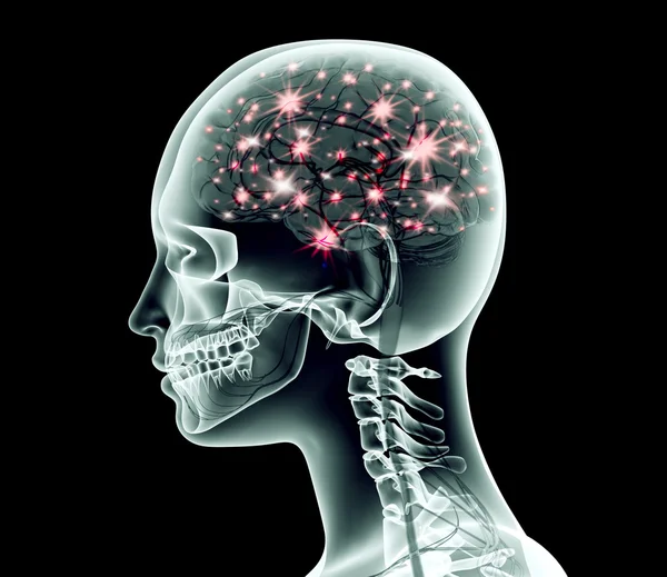 脳と電気パルスの人体頭部の x 線のイメージ — ストック写真