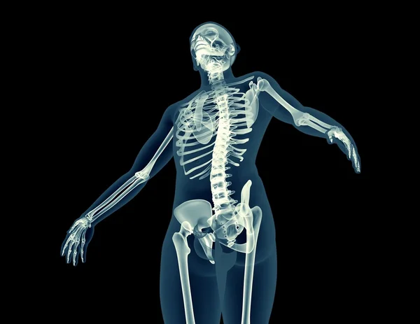 Bir insan vücudunun x-ray görüntüsü — Stok fotoğraf