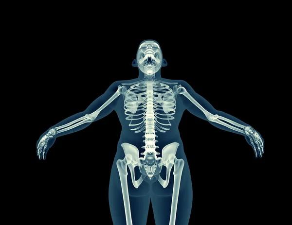 Bir insan vücudunun x-ray görüntüsü — Stok fotoğraf