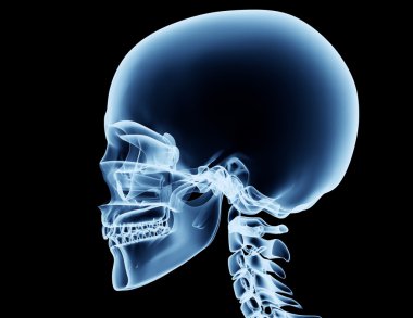 x-ray görüntü üzerinde siyah izole bir adamın