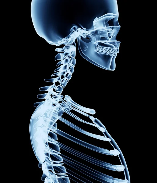 Imagem de raio-x de um homem isolado em preto — Fotografia de Stock