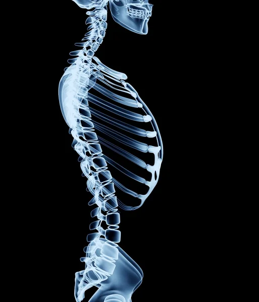 X-ray image of a man isolated on black — Stock Photo, Image