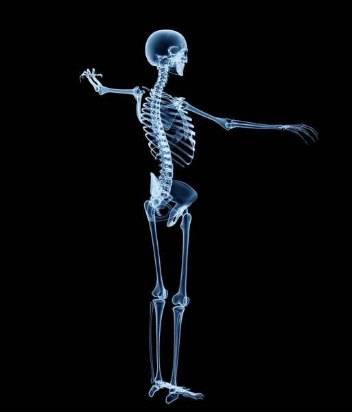 X-ray görüntü üzerinde siyah izole bir adamın — Stok fotoğraf