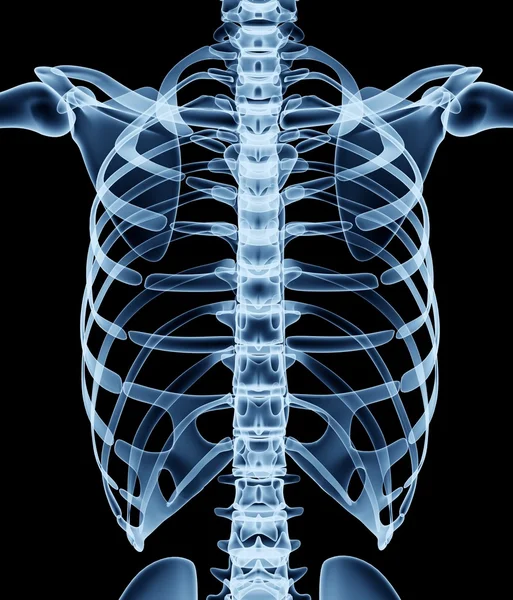 X-ray görüntü üzerinde siyah izole bir adamın — Stok fotoğraf