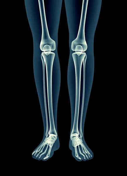 Imagen de rayos X de un hombre aislado en negro — Foto de Stock