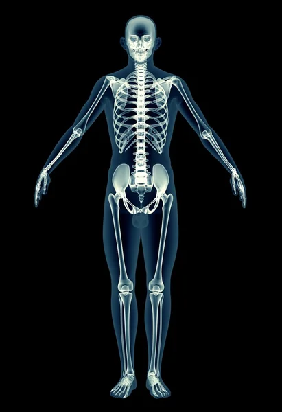 X-ray görüntü üzerinde siyah izole bir adamın — Stok fotoğraf