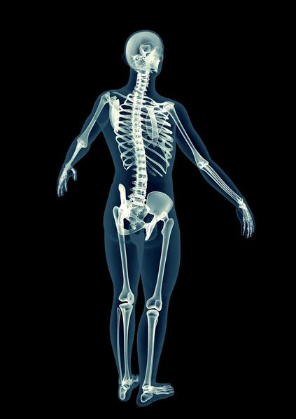 X-ray görüntü üzerinde siyah izole bir adamın — Stok fotoğraf