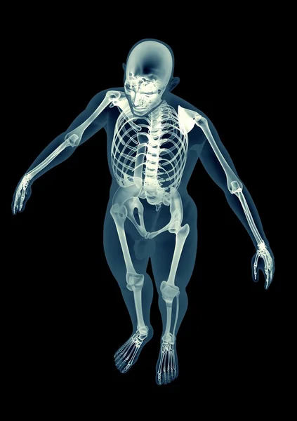 Imagen de rayos X de un hombre aislado en negro —  Fotos de Stock