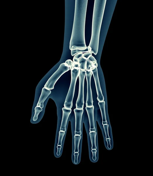 X-ray image of a man isolated on black — Stock Photo, Image