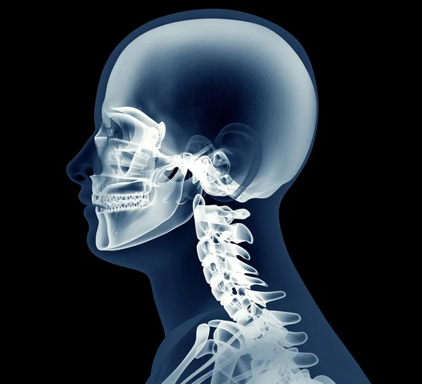 X-ray image of a man isolated on black — Stock Photo, Image