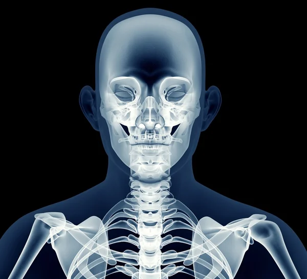 X-ray görüntü üzerinde siyah izole bir adamın — Stok fotoğraf