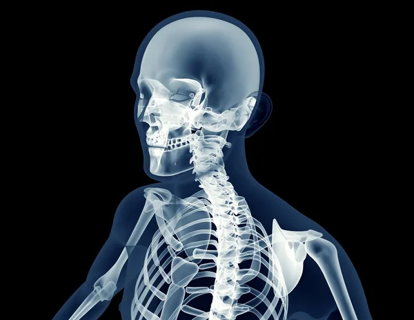 Röntgenbild eines Mannes isoliert auf schwarz — Stockfoto